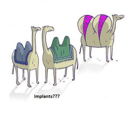 Camelback upgrade gone wild!